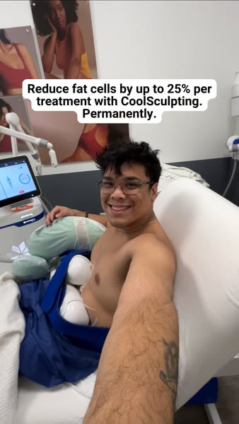 Smiling shirtless man taking a selfie during a CoolSculpting session with caption about reducing fat cells by 25%
