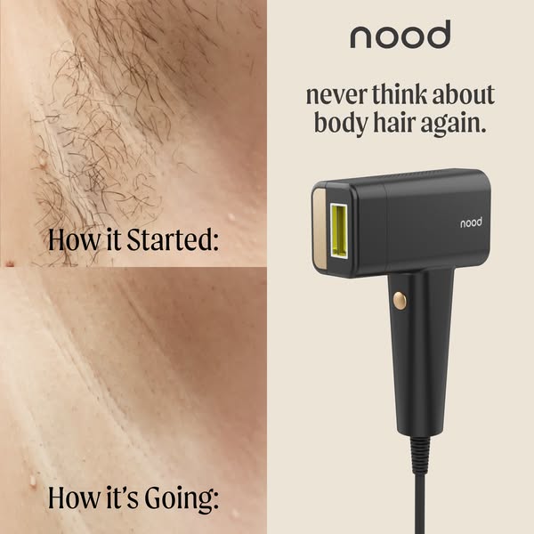 Underarm before and after with hair on top and smooth skin below, next to a black Nood IPL device and the headline