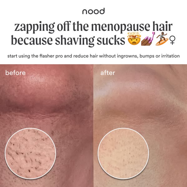 Chin before and after with magnified circles showing dark stubble, then smooth skin, under a menopause headline