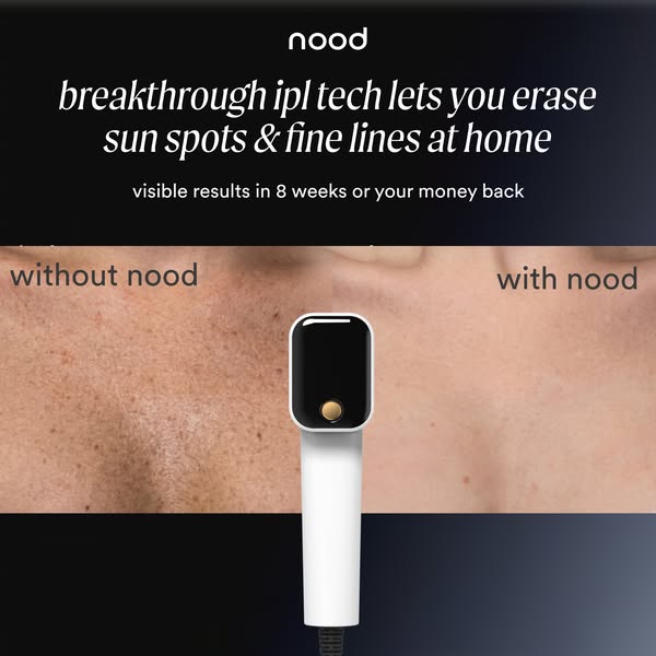 Dark background ad with a white Nood IPL device between before and after chest close-ups showing sun spots and clear skin