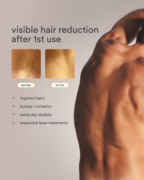 Muscular male back beside before and after skin swatches showing hair then smooth skin, with a list of pains IPL removes