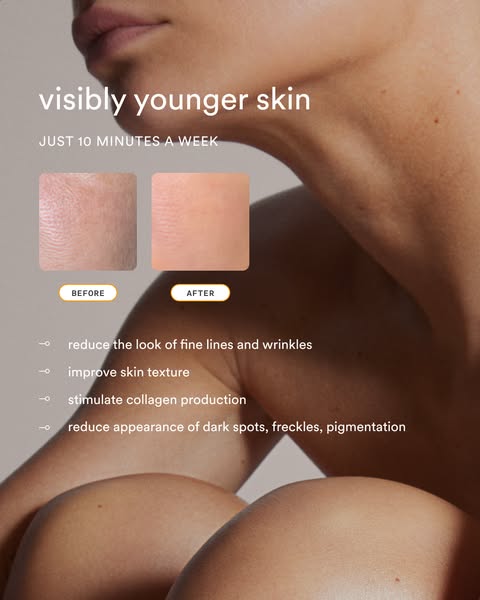 Close-up of a woman's neck and shoulders with before and after skin swatches and four anti-aging benefits listed