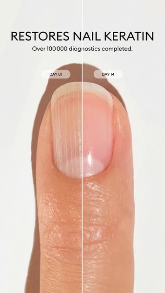 One fingernail split down the middle: ridged and dull on day 1, smooth and pink on day 14 after keratin treatment